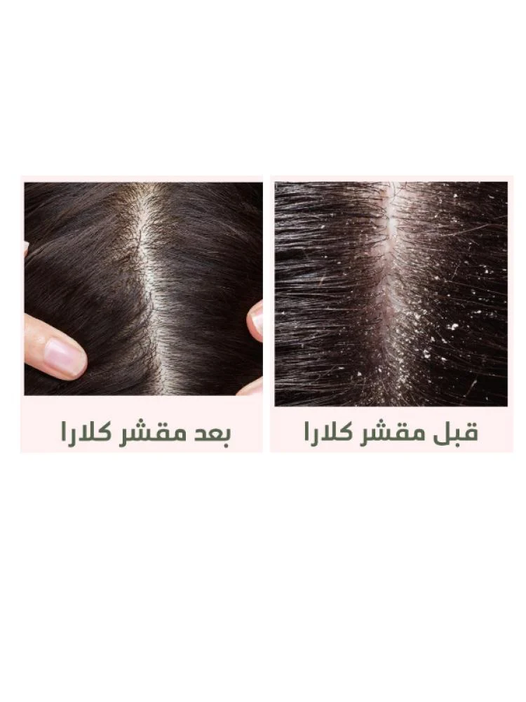 سكراب منقي لفروة الرأس من كلارا – 250 مل
